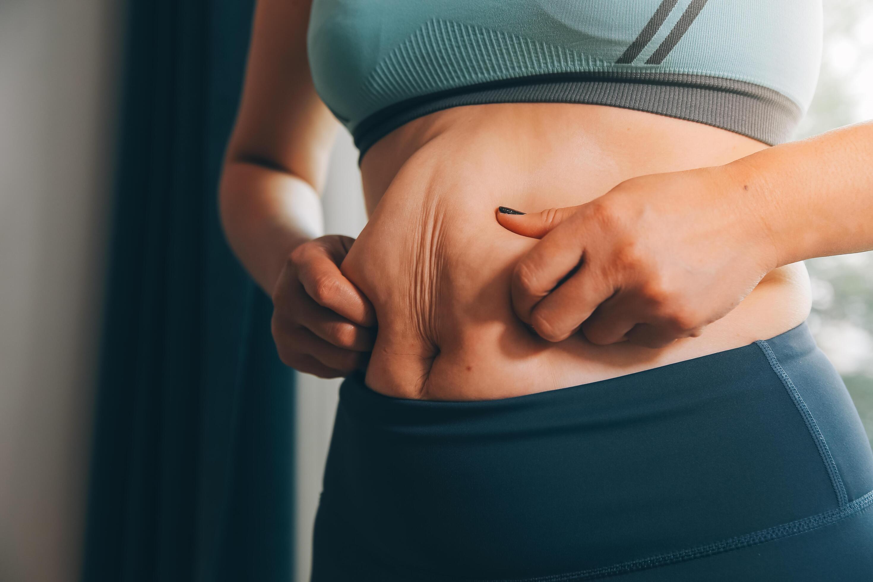 fat woman, fat belly, chubby, obese woman hand holding excessive belly fat with measure tape, woman diet lifestyle concept Stock Free