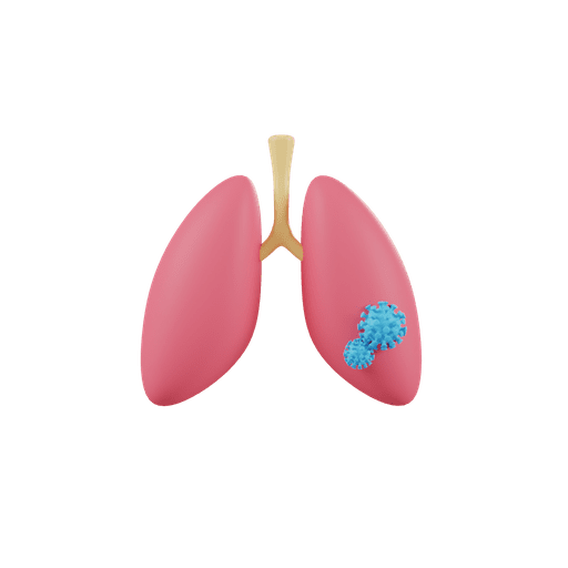 Lungs, infection, coronavirus 3D illustration