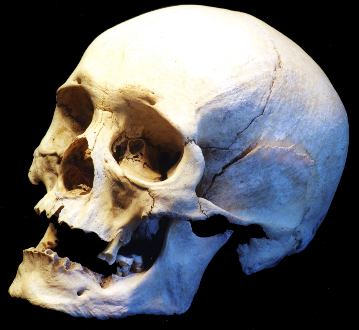 Human skull, side view Stock Free