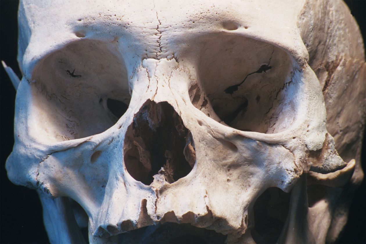 Human skull closeup Stock Free