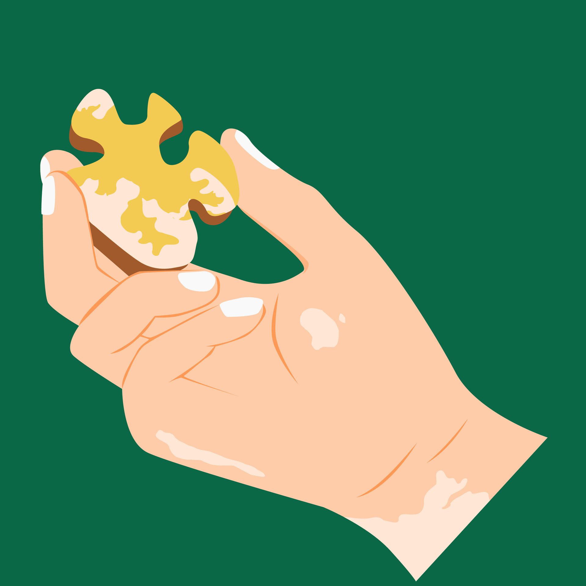 Illustration of a hand with vitiligo holding a vitiligo-patterned puzzle Free Vector