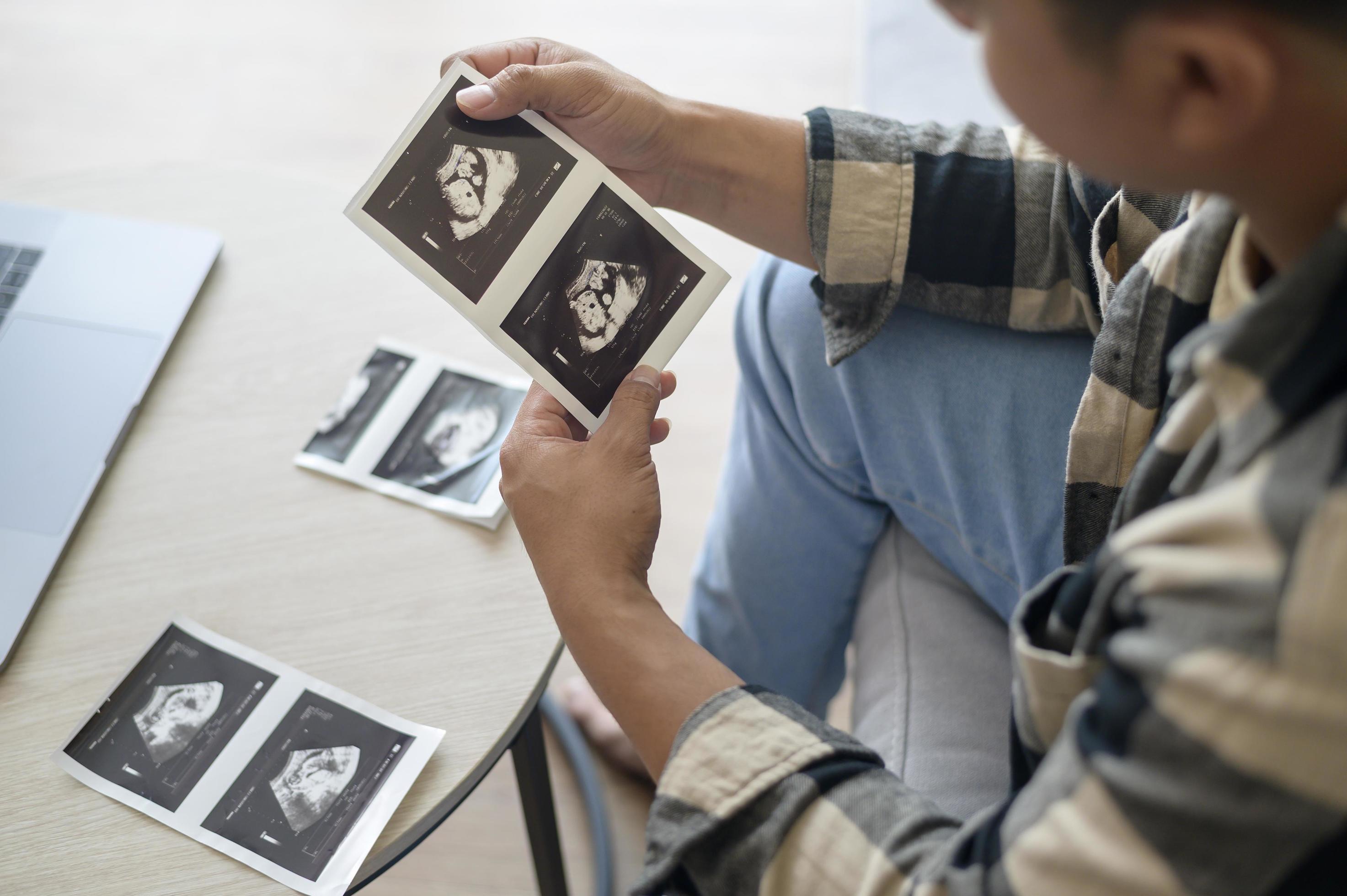 Young father holding ultrasound photo of newborn baby, maternity and family concept Stock Free